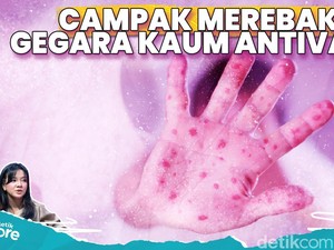 Secepat Apa Penyakit Campak Merebak?