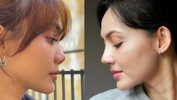 Rina Nose Perlihatkan Before-After Hidung Usai Oplas, Pangling Gak?