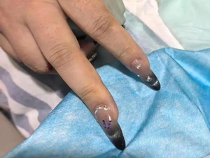 Kisah Wanita Hampir Kehilangan Nyawa Karena Manikur Gel
