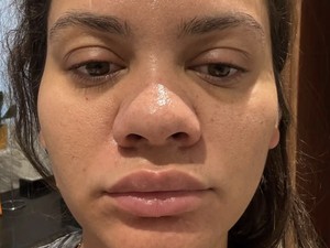 Curhat Beauty Influencer Syok Wajahnya Berubah Drastis Saat Hamil
