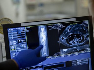 Mumi Mesir Kuno Diteliti dengan CT Scan, Seperti Ini Bentuk Aslinya