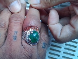 Dokter Angkat Tangan, Damkar Kuningan Evakuasi Cincin di Jari Korban Kecelakaan