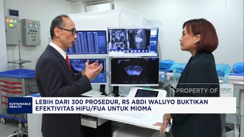 Video: 300 Prosedur HIFU/FUA RS Abdi Waluyo:Solusi Mioma Tanpa Operasi