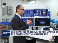 Video: 300 Prosedur HIFU/FUA RS Abdi Waluyo:Solusi Mioma Tanpa Operasi