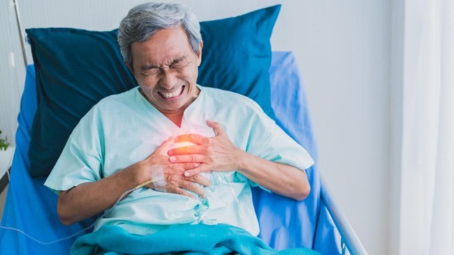 Tim Dokter Ini Gunakan Rotablator untuk Tembus Sumbatan Jantung