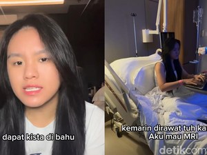 Kondisi Terkini Wanita Jakbar yang Idap Kista Bahu Diduga karena Keseringan Padel