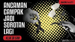 Dokter Muda di Cianjur Meninggal Diduga Campak, Pakar Soroti Komplikasi Pneumonia