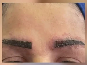 Berawal Dari Tato Alis, Wanita Ini Berakhir Alami Penyakit Serius