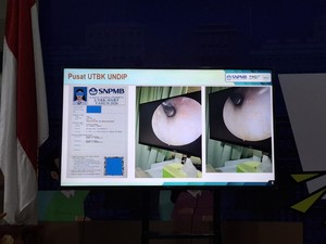 Curang! Ini Potret Alat Dengar yang Ditanam di Telinga Peserta UTBK