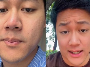 Pria Jakut Kena Kanker Limfoma di Usia 25 Tahun, Inikah Penyebabnya?