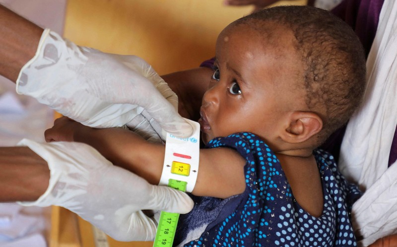 Seorang perempuan Somalia yang mengungsi di dalam negeri memberi makan anaknya yang kekurangan gizi di rumah sakit Daynile karena kekurangan makanan terapeutik yang menyelamatkan nyawa akibat gangguan pengiriman karena perang Iran telah memaksa klinik-klinik yang merawat anak-anak yang sangat kekurangan gizi untuk menolak pasien dan membatasi persediaan di Somalia yang dilanda kekeringan, di distrik Daynile, Mogadishu, Somalia, 20 April 2026. (REUTERS/Feisal Omar)