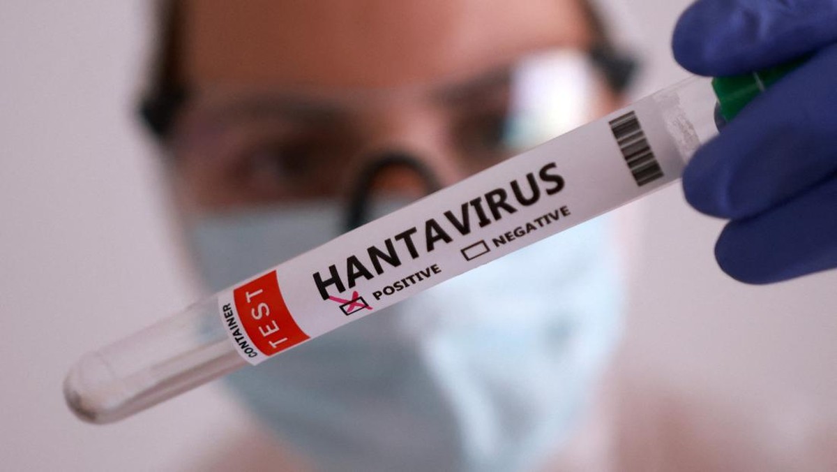 23 Kasus Hantavirus Terdeteksi di Indonesia, Kenali Gejalanya