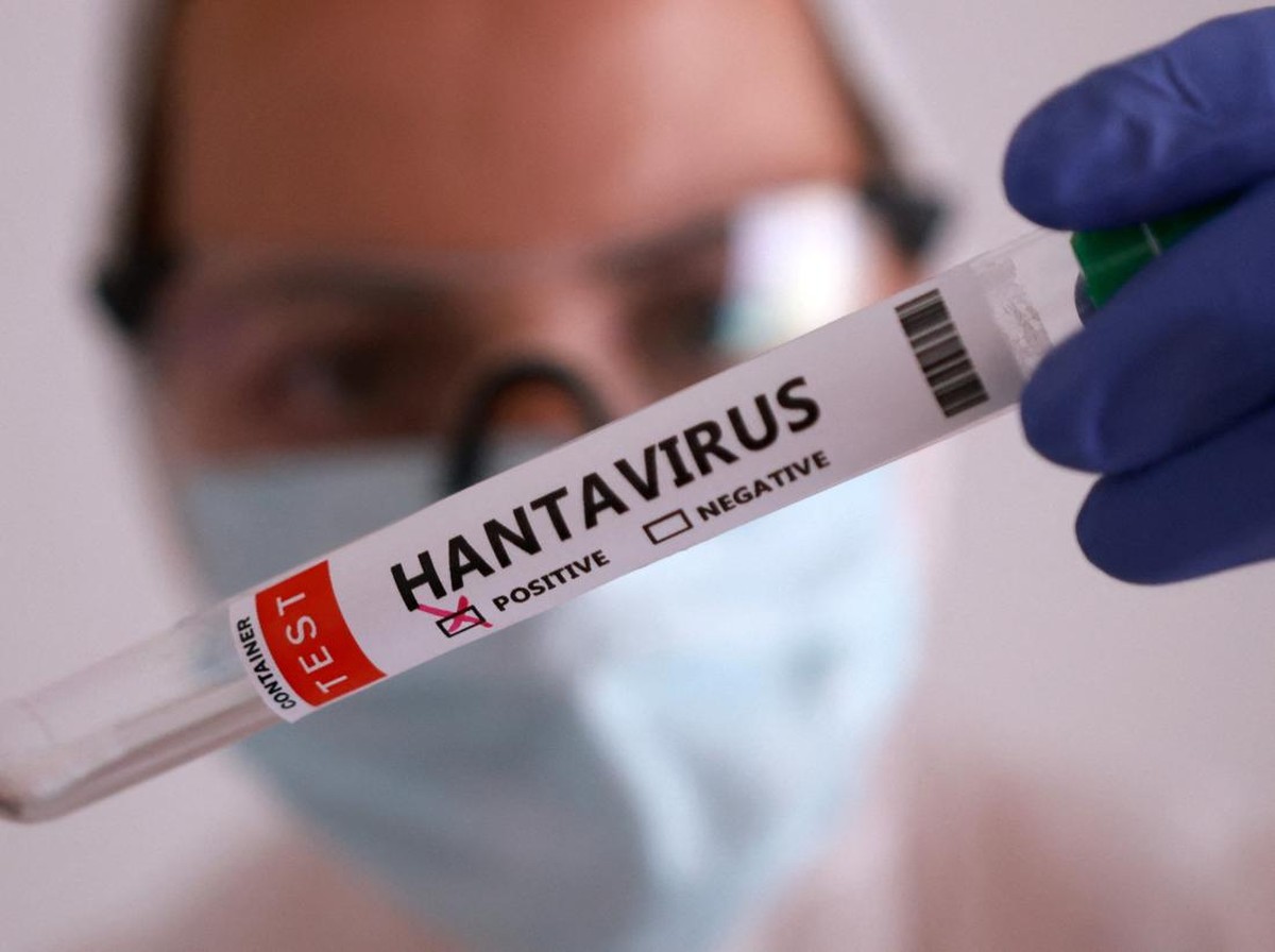 Wabah Hantavirus Andes Virus Tewaskan Penumpang, Indonesia Catat Kasus Seoul Virus