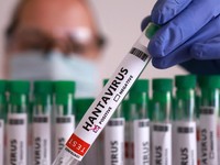 Dalam ilustrasi ini, yang diambil pada 7 Mei 2026, terlihat sebuah tabung reaksi berlabel "Hantavirus positif". (REUTERS/Dado Ruvic/Illustration)