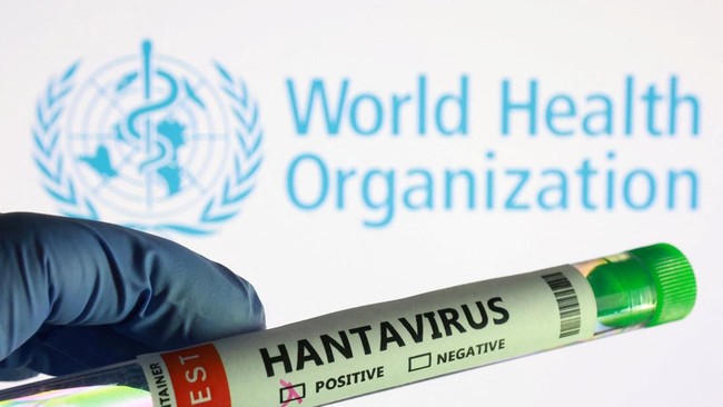 WHO Ungkap 8 Kasus Hantavirus Andes, Bisa Menular Antar Manusia?