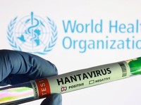 Dalam ilustrasi ini, yang diambil pada 7 Mei 2026, terlihat sebuah tabung reaksi berlabel "Hantavirus positif" dan logo Organisasi Kesehatan Dunia. (REUTERS/Dado Ruvic/Illustration)