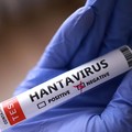 Dalam ilustrasi ini, yang diambil pada 7 Mei 2026, terlihat sebuah tabung reaksi berlabel "Negatif Hantavirus". (REUTERS/Dado Ruvic/Illustration)