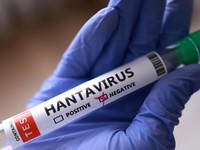 Dalam ilustrasi ini, yang diambil pada 7 Mei 2026, terlihat sebuah tabung reaksi berlabel "Negatif Hantavirus". (REUTERS/Dado Ruvic/Illustration)
