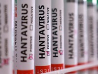 Tabung reaksi berlabel "Positif Hantavirus" dalam ilustrasi ini yang diambil pada 7 Mei 2026. (REUTERS/Dado Ruvic/Illustration)