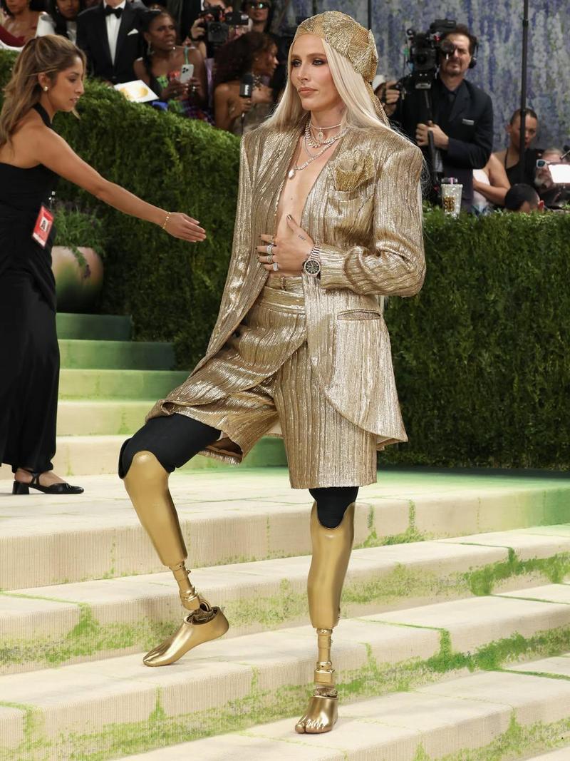 Viral Model Berkaki Emas di Met Gala, Kakinya Diamputasi karena Tampon