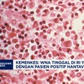 Kemenkes: WNA Kontak Langsung Pasien Hantavirus Masih Aman