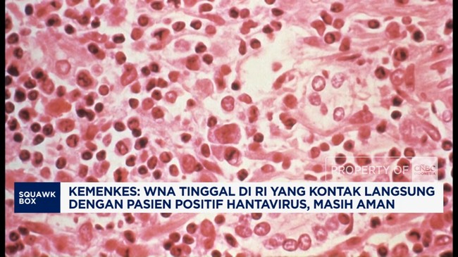 Video: Kemenkes: WNA Kontak Langsung Pasien Hantavirus Masih Aman