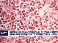 Kemenkes: WNA Kontak Langsung Pasien Hantavirus Masih Aman