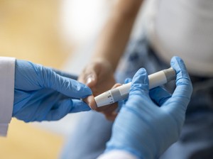 Bongkar Penyebab Luka Diabetes Sulit Sembuh dan Pengobatannya