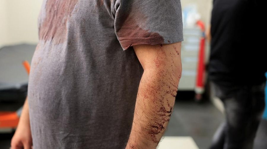 Palestinian father Fahed Abu Haykal stands in a Hebron hospital emergency room with his clothes stained with blood after his seven-month-old baby was killed by Israeli forces, in Hebron in the Israeli-occupied West Bank, June 5, 2026. REUTERS/Mussa Q