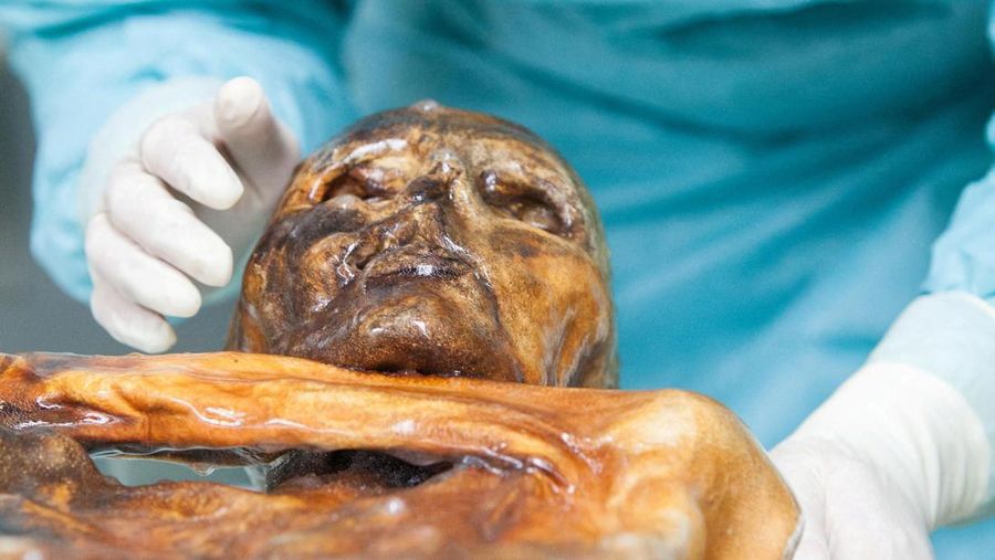 Seorang peneliti memeriksa sisa-sisa mumi Otzi, seorang pria yang tubuhnya terawetkan dalam es gletser selama lebih dari 5.300 tahun, di ruang konservasi di Museum Arkeologi Tyrol Selatan di Bolzano, Italia. (Museum Arkeologi Tyrol Selatan/Eurac Rese