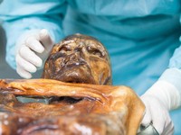 Seorang peneliti memeriksa sisa-sisa mumi Otzi, seorang pria yang tubuhnya terawetkan dalam es gletser selama lebih dari 5.300 tahun, di ruang konservasi di Museum Arkeologi Tyrol Selatan di Bolzano, Italia. (Museum Arkeologi Tyrol Selatan/Eurac Rese