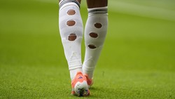 Viral Kaos Kaki Bolong Jude Bellingham di Piala Dunia, Ternyata Ada Fungsinya