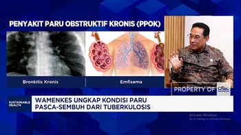 Penyakit Paru Gak Cuma Bahaya Bagi Kesehatan Tapi Bebani Negara, Ini Buktinya!