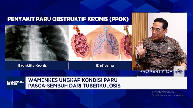 Video: Penyakit Paru Gak Cuma Bahaya Bagi Kesehatan Tapi Bebani Negara