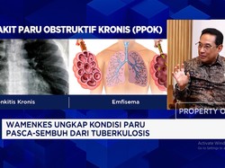 Penyakit Paru Gak Cuma Bahaya Bagi Kesehatan Tapi Bebani Negara, Ini Buktinya!