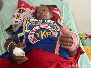 Relawan Mojokerto Digigit Ular Kobra, 2 Tangannya Harus Dioperasi