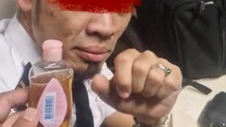 Pilot Malaysia Airlines Positif 3 Narkoba Bawa Urine Bersih Buat Tipu Petugas