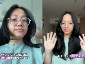Dikira Gejala Maag, Perempuan Palangka Raya Ini Ternyata Kena Tumor