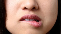 Stop Jilati Bibir! Begini Cara Paling Efektif Atasi Bibir Kering