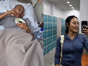 Kisah Haru Naya Lawan Kanker Limfoma Stadium 4: Sempat Divonis Hidup 3 Bulan