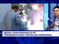 Wamenkes Jamin Dokter & Teknologi Kesehatan RI Sudah Canggih, Warga RI Tak Perlu Berobat ke Luar Negeri