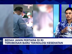 Wamenkes Jamin Dokter & Teknologi Kesehatan RI Sudah Canggih, Warga RI Tak Perlu Berobat ke Luar Negeri