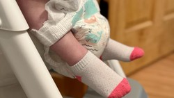 Sering Menahan BAB Bikin Anak Kena Usus Buntu? Pakar IDAI Ungkap Faktanya