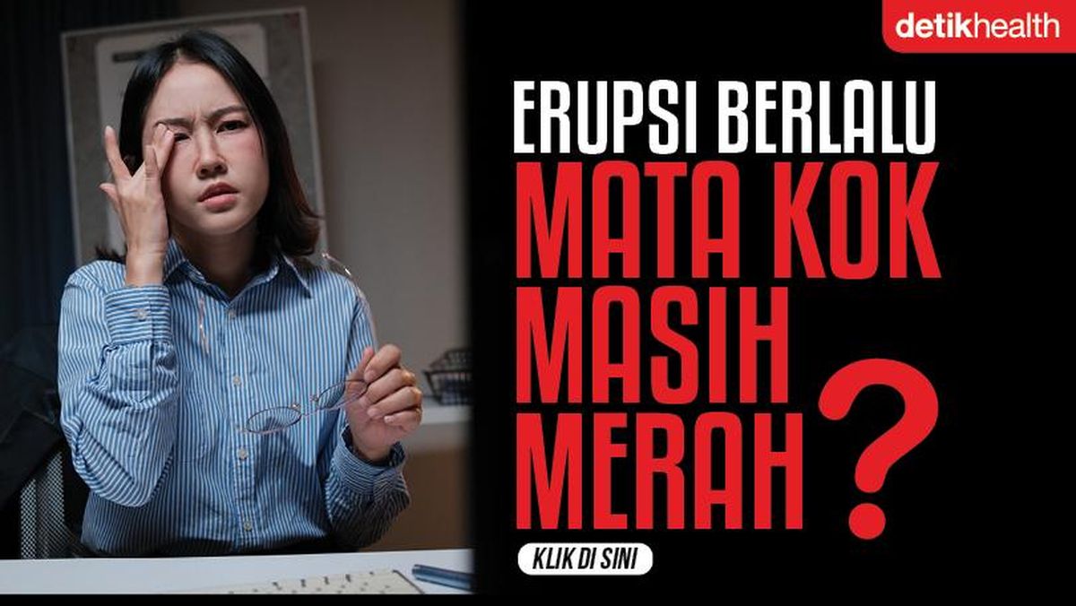 Erupsi Berlalu, Kok Mata Masih Merah? Ini Kemungkinannya Menurut Dokter Mata