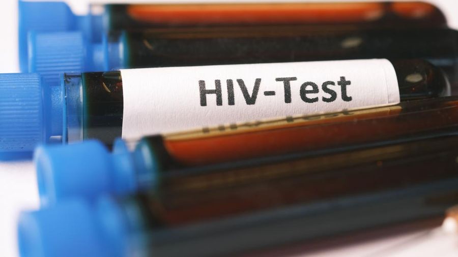 Ilustasi HIV. (Dok. Pexels)