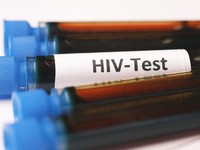 Ilustasi HIV. (Dok. Pexels)