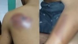 Pilu Santri Difabel Gresik Disetrika Senior hingga Ogah Mondok Lagi