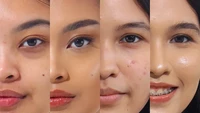 Cara Pakai Concealer High Coverage di Kulit Berjerawat Biar Tidak Cakey 