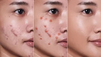 Peach atau Orange? Cara Pilih Color Corrector Sesuai Warna Mata Panda Kamu 