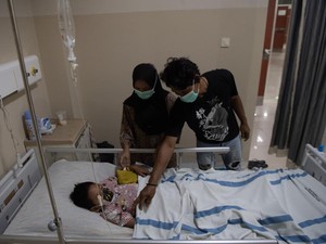 Dokter Paru Beberkan Beda Sesak Napas Akibat Asap Karhutla Vs ISPA